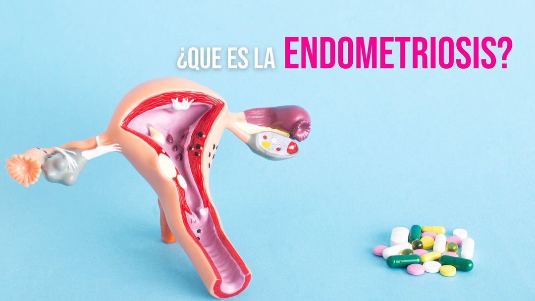 Endometriosis menstrual menstruacion pms spm  cramp infertility